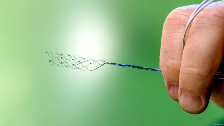 Nuevos chips buscan competirle a Elon Musk en el rubro de implantes cerebrales